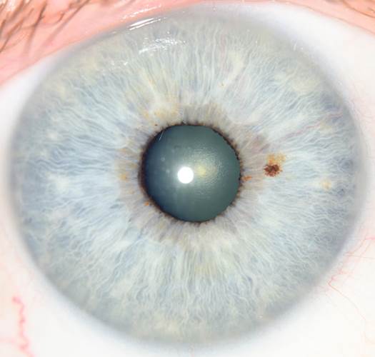 A close-up of a blue eye
Description automatically generated with medium confidence