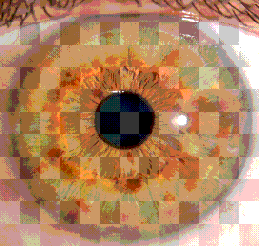 A close up of an eye
Description automatically generated