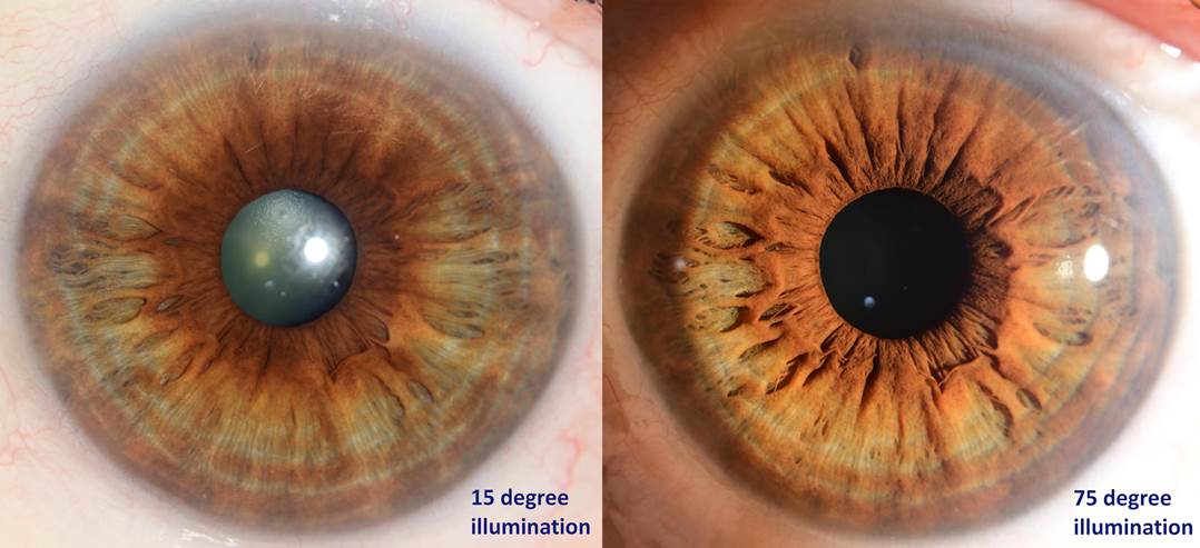 A close up of an eyeball
Description automatically generated