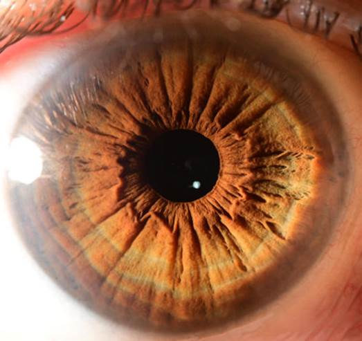 A close up of an eye
Description automatically generated