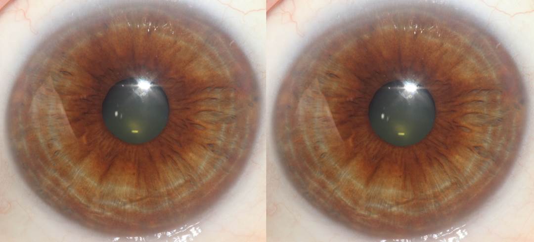 A close up of a pair of brown eyes
Description automatically generated