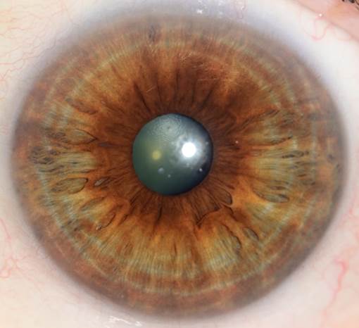 A close up of an eye
Description automatically generated