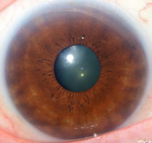 A close up of an eye
Description automatically generated with medium confidence