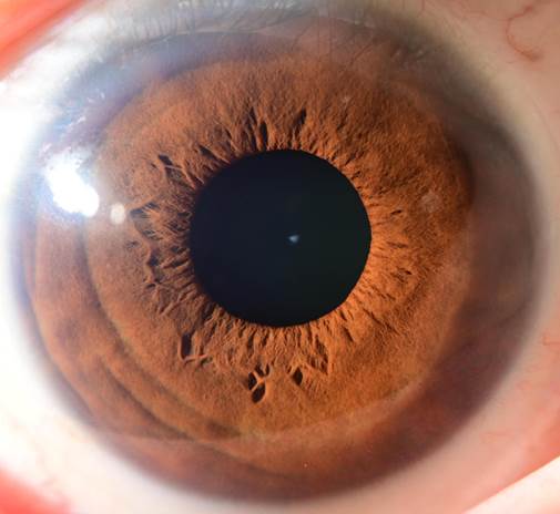 A close up of an eye
Description automatically generated