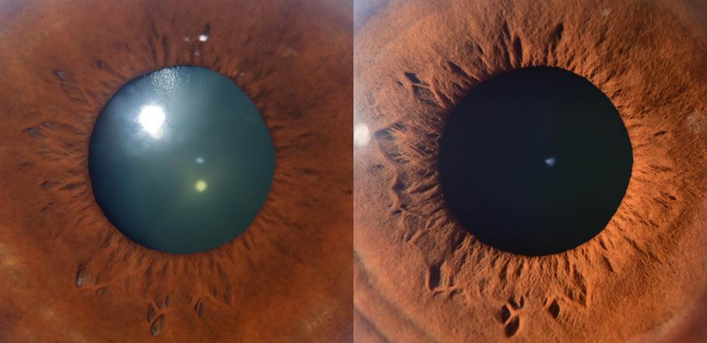 A close up of an eye
Description automatically generated with low confidence