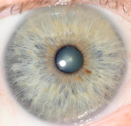 A close-up of a person's eye
Description automatically generated