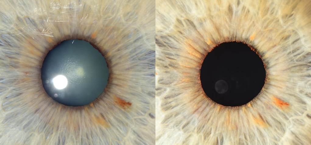 A close up of an eye
Description automatically generated with low confidence