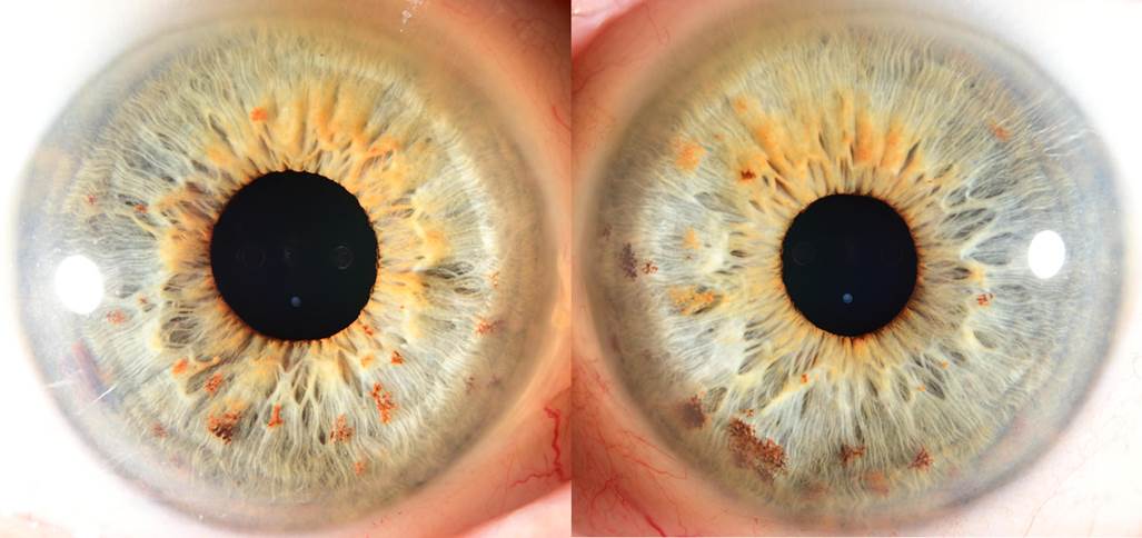 Close up of an eye
Description automatically generated