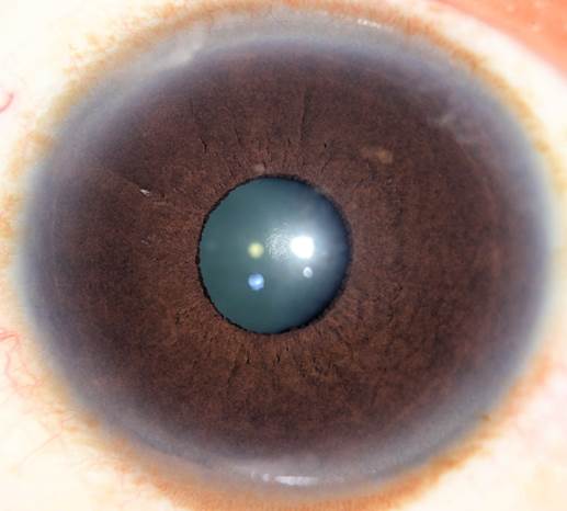 A close-up of an eyeball
Description automatically generated