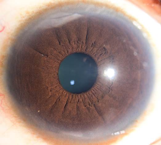 A close up of an eye
Description automatically generated