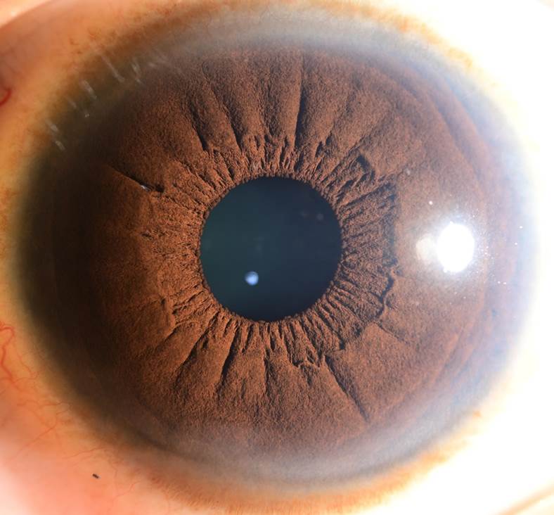A close up of an eyeball with Meteor Crater in the background
Description automatically generated with medium confidence