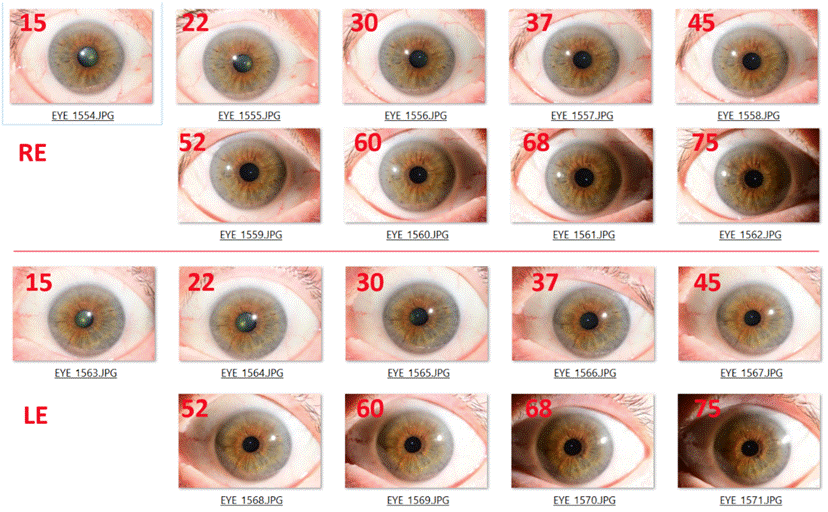 A screenshot of a screenshot of a person's eyes
Description automatically generated